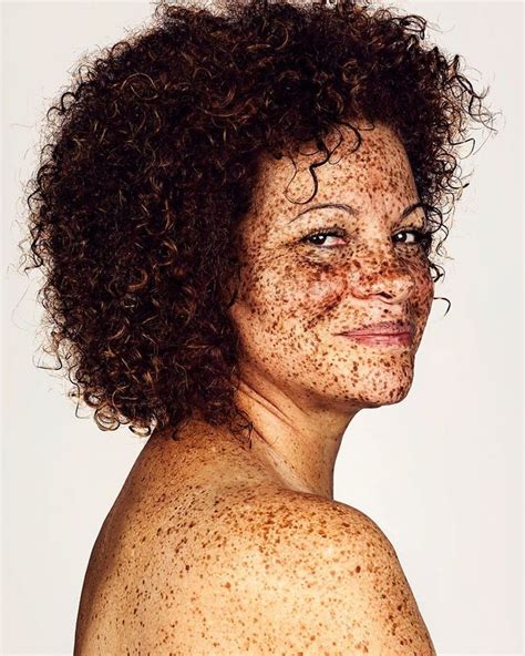Freckles 18: A Journey Through the Life of a Unique Individual