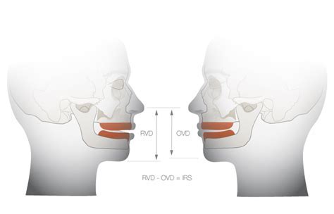 Height Insights: Understanding Lily Madison's Vertical Dimension