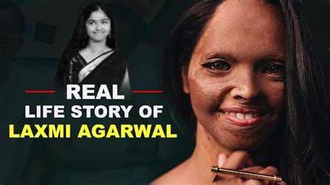 Laxmi Agarwal: A Story of Courage and Resilience