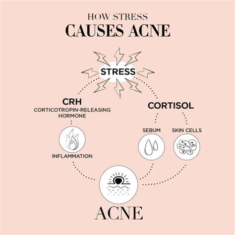 Say No to Stress: Discover the Connection between Stress and Skin Health