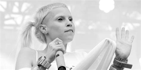 Unveiling Yolandi Visser's Wealth and Career Milestones